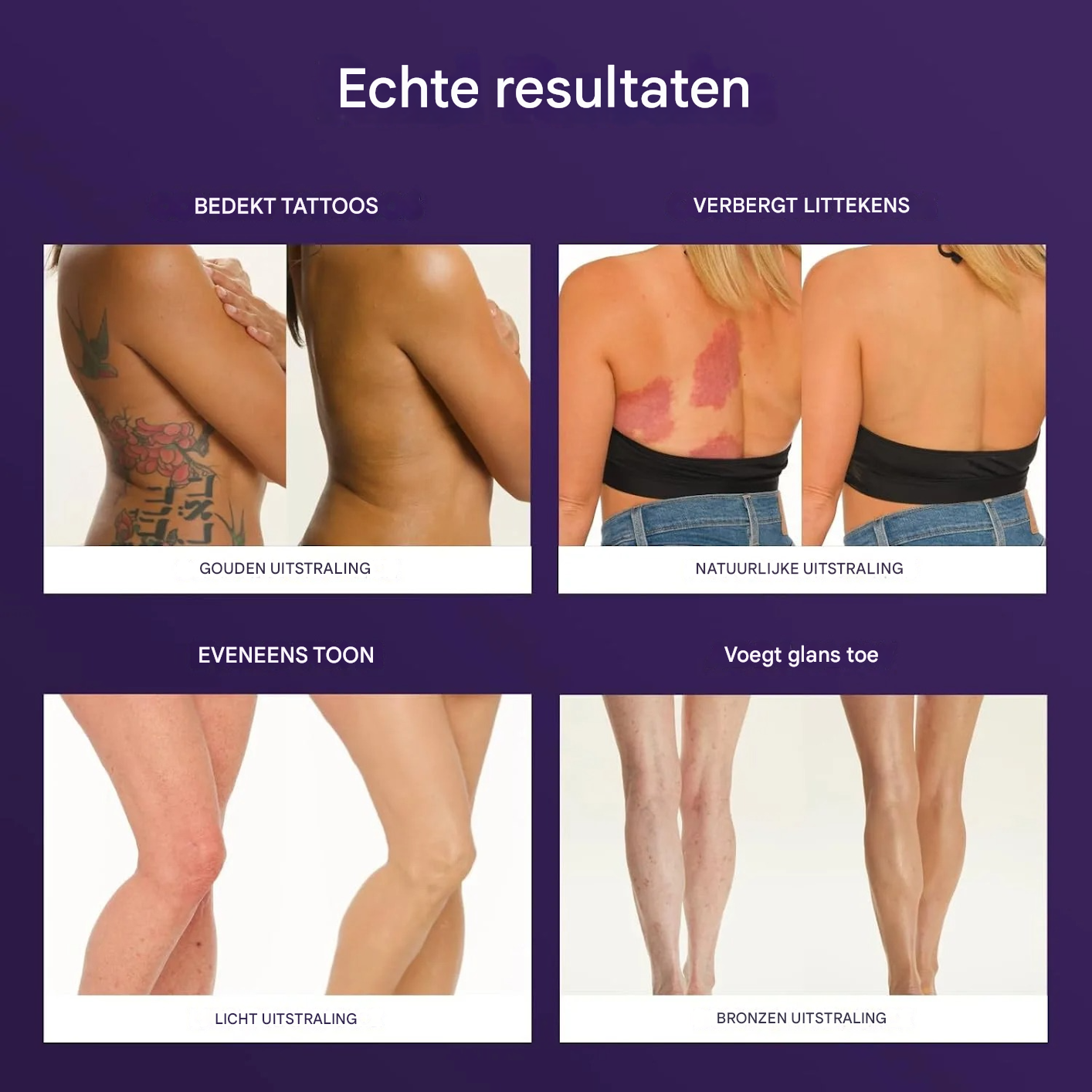 TrueSkin™ | Verbergt spataderen, littekens, pigmentvlekken en meer! | 1+1 gratis